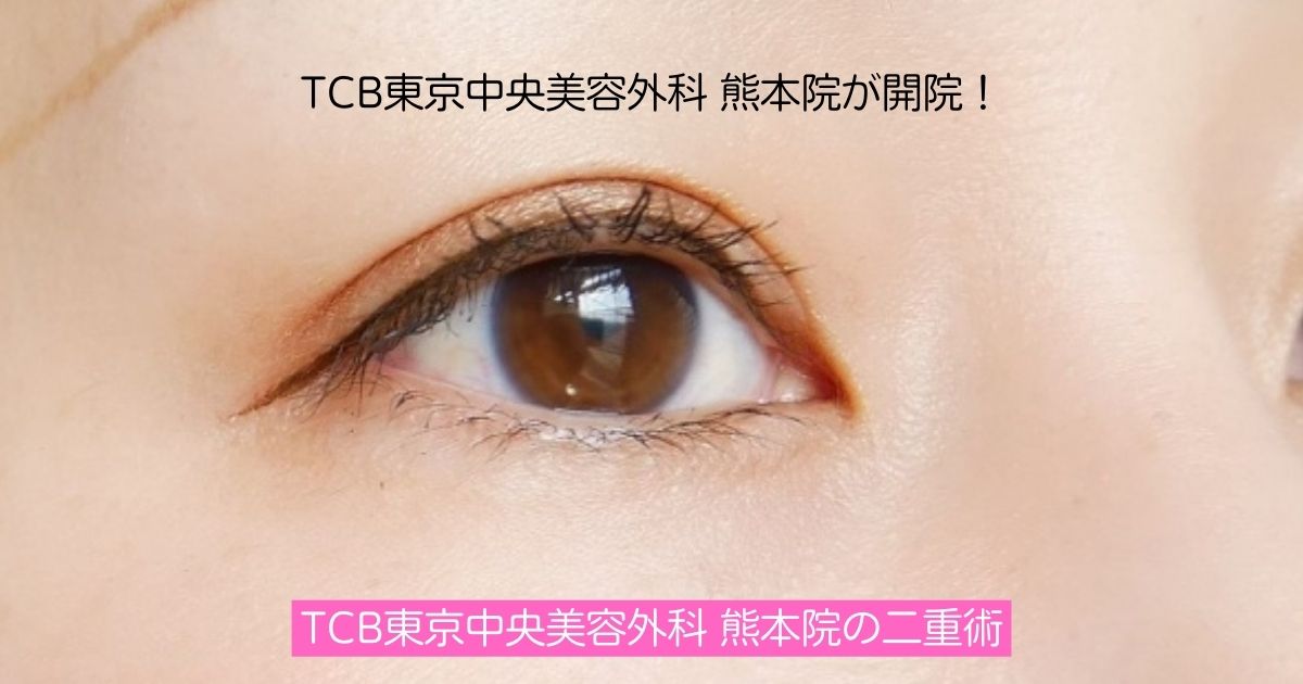 Tcbの二重術 アイプチからの解放 埋没法の二重術なら口コミ人気のtcb熊本院がおすすめ 熊本しるなび